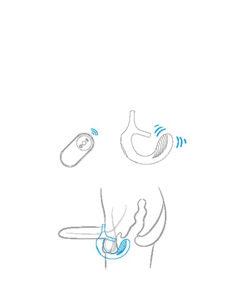 RINGS OF LOVE TEASER DE PAREJA REMOTO